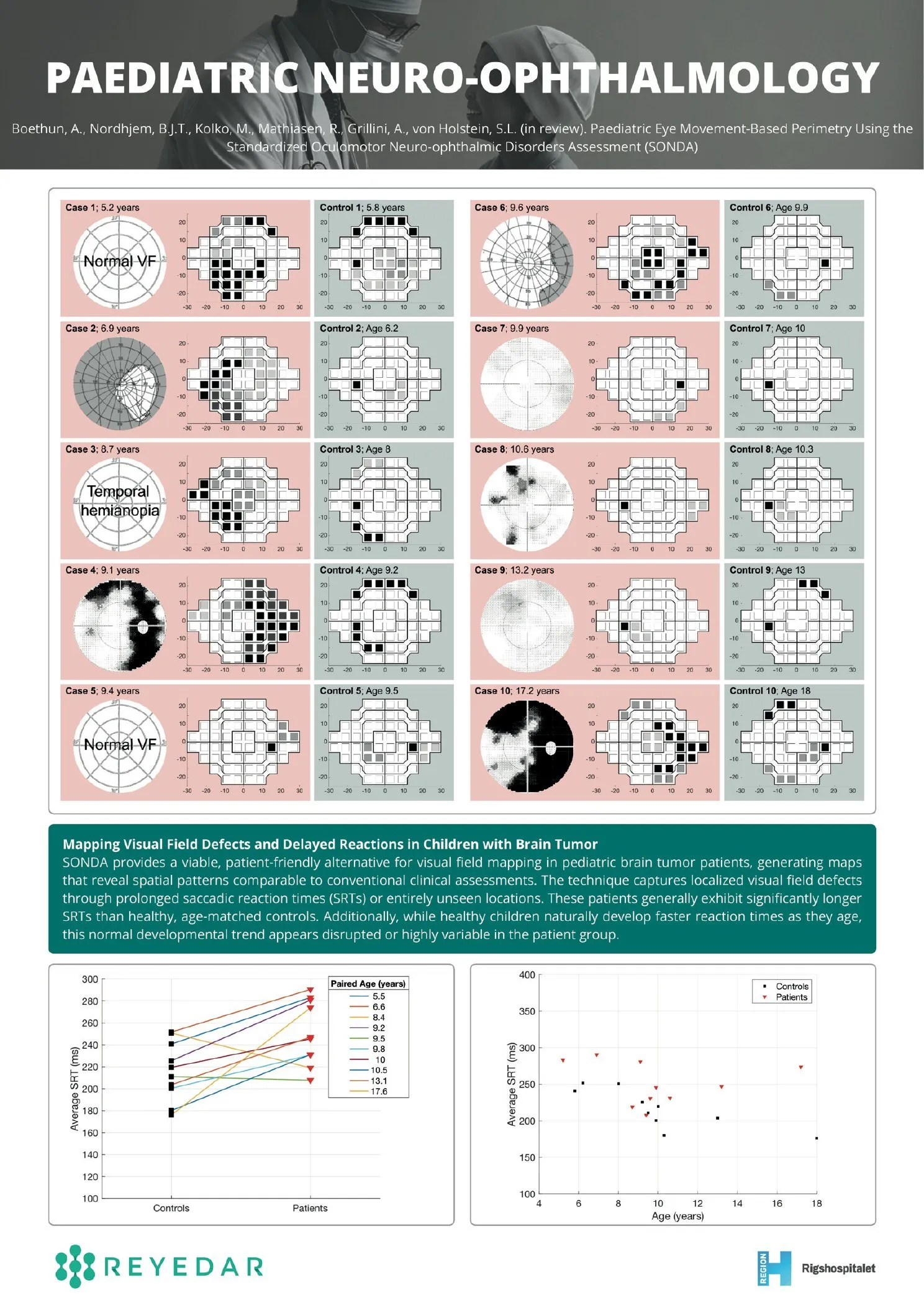 Poster: paediatric eye movement-based perimetry